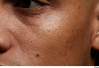 HD Face Skin Rahil Waters cheek face skin pores skin…